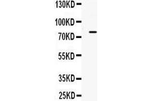 Observed bind size: 80KD (ADRBK2 抗体  (C-Term))