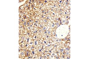 Immunohistochemical analysis of paraffin-embedded M. (CSNK1G3 抗体  (C-Term))