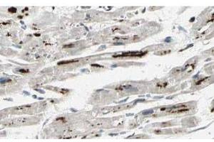 Affinity Purified anti-iASPP antibody shows strong cytoplasmic and membranous staining of myocytes in human heart tissue. (PPP1R13L 抗体  (Isoform 1))