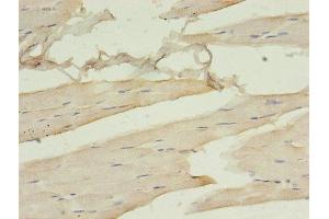Immunohistochemistry of paraffin-embedded human skeletal muscle tissue using ABIN7161378 at dilution of 1:100 (Doublecortin 抗体  (AA 108-360))