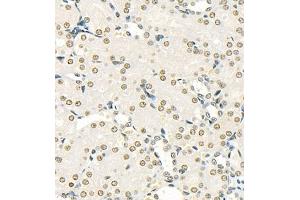 Immunohistochemistry (Paraffin-embedded Sections) (IHC (p)) image for anti-Suppressor of Variegation 3-9 Homolog 1 (Drosophila) (SUV39H1) antibody (ABIN7075770)