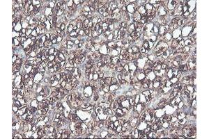 Image no. 9 for anti-CNDP Dipeptidase 2 (Metallopeptidase M20 Family) (CNDP2) antibody (ABIN1497548) (CNDP2 抗体)