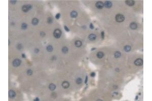Immunohistochemistry (IHC) image for anti-Arylsulfatase A (ARSA) antibody (ABIN7441370)