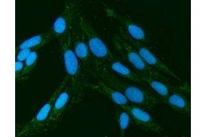 IF analysis of Kindlin 2/FERMT2 using anti-Kindlin 2/FERMT2 antibody (ABIN7599515). (FERMT2 抗体  (AA 1-650))