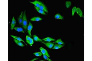 Immunofluorescent analysis of Hela cells using ABIN7146755 at dilution of 1:100 and Alexa Fluor 488-congugated AffiniPure Goat Anti-Rabbit IgG(H+L) (CMBL 抗体  (AA 2-245))