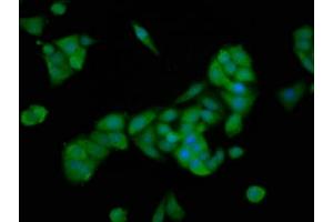 Immunofluorescence staining of PC-3 cells with ABIN7168748 at 1:166, counter-stained with DAPI. (PTTG2 抗体  (AA 1-202))