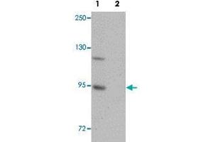 Western blot analysis of mouse brain tissue with ZC3H12B polyclonal antibody  at 1 ug/mL in (Lane 1) the absence and (Lane 2) the presence of blocking peptide . (ZC3H12B 抗体  (N-Term))