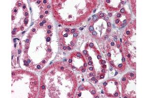 Immunohistochemistry (IHC) image for anti-TBC1 (Tre-2/USP6, BUB2, Cdc16) Domain Family, Member 1 (TBC1D1) (AA 612-661) antibody (ABIN6747172)
