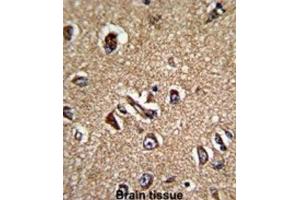 Immunohistochemistry (IHC) image for anti-Serine/threonine Kinase Receptor Associated Protein (STRAP) antibody (ABIN3001728) (STRAP 抗体)