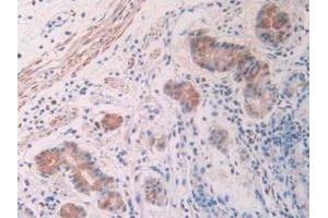 Detection of ACVR2A in Human Stomach Tissue using Polyclonal Antibody to Activin A Receptor Type II A (ACVR2A)