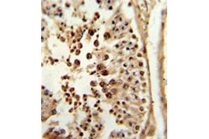 Formalin-fixed and paraffin-embedded human testis tissue reacted with PPP3R2 / CBLP Antibody (N-term) followed which was peroxidase-conjugated to the secondary antibody, followed by DAB staining. (Calcineurin B 抗体  (N-Term))