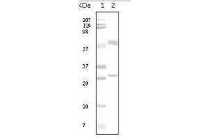 Western Blotting (WB) image for anti-Estrogen Receptor 1 (ESR1) antibody (ABIN1107144) (Estrogen Receptor alpha 抗体)