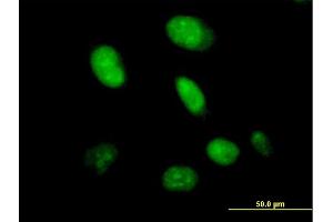 Immunofluorescence of purified MaxPab antibody to CXorf43 on HeLa cell. (HDX 抗体  (AA 1-690))