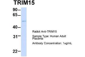 Host: Rabbit  Target Name: TRIM15  Sample Tissue: Human Adult Placenta  Antibody Dilution: 1. (TRIM15 抗体  (Middle Region))