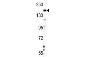 Western blot analysis of Nestin antibody and HepG2 lysate (Nestin 抗体  (AA 1389-1416))