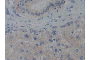 Detection of CENPH in Human Liver Tissue using Polyclonal Antibody to Centromere Protein H (CENPH) (CENPH 抗体  (AA 1-247))