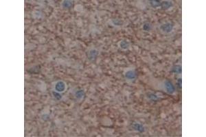 IHC-P analysis of Human Tissue, with DAB staining. (GRIA2 抗体  (AA 25-543))