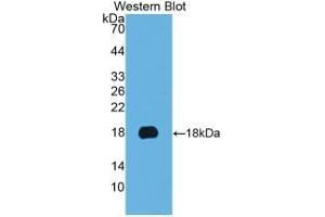 Detection of Recombinant KRT19, Human using Monoclonal Antibody to Cytokeratin 19 (CK19) (Cytokeratin 19 抗体  (AA 245-391))