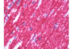 Anti-Myelin Basic Protein / MBP antibody IHC staining of human brain, cerebellum.