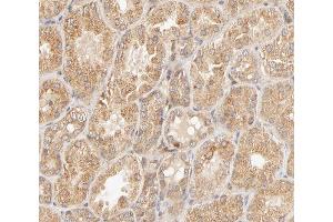 ABIN6267650 at 1/200 staining human kidney tissue sections by IHC-P. (STAT4 抗体  (pTyr693))