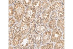 ABIN6267650 at 1/200 staining human kidney tissue sections by IHC-P.