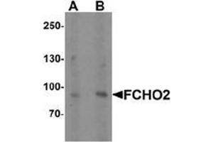 Western blot analysis of FCHO2 in rat heart tissue lysate with FCHO2 Antibody  at (A) 1 and (B) 2 µg/ml (FCHO2 抗体  (Middle Region))