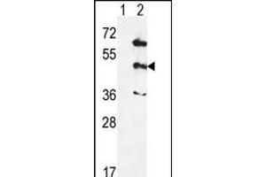 Western blot analysis of PK12 (arrow) using rabbit polyclonal hPK12- (ABIN391329 and ABIN2841359). (MAPK12 抗体  (AA 339-367))