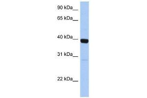 ZNF385B antibody used at 0. (ZNF385B 抗体  (C-Term))