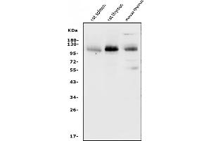 Western blot analysis of SELPLG using anti-SELPLG antibody (ABIN7600341).
