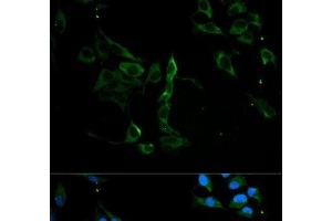 Immunofluorescence analysis of U2OS cells using MVP Polyclonal Antibody at dilution of 1:100. (MVP 抗体)