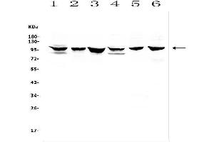 Western blot analysis of DDR1 using anti-DDR1 antibody (ABIN7601407). (DDR1 抗体  (AA 341-909))