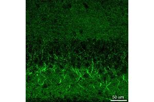 Immunohistochemistry (IHC) image for anti-gamma-aminobutyric Acid (GABA) A Receptor, beta 3 (GABRB3) (AA 344-429) antibody (ABIN1742464)
