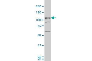 TBC1D8 monoclonal antibody (M02), clone 1A12 Western Blot analysis of TBC1D8 expression in K-562 . (TBC1D8 抗体  (AA 1-110))