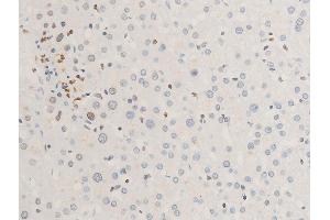 Immunohistochemistry (IHC) image for anti-Receptor tyrosine-protein kinase erbB-2 (ErbB2/Her2) (pTyr1112) antibody (ABIN6255774)