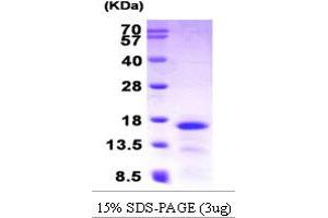 SDS-PAGE (SDS) image for Chemokine (C-C Motif) Ligand 28 (CCL28) (AA 23-127) protein (His tag) (ABIN666664)