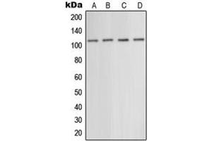 Western blot analysis of mGLUR5 expression in EOC20 (A), mouse liver (B), rat liver (C), rat brain (D) whole cell lysates. (Metabotropic Glutamate Receptor 5 抗体  (N-Term))