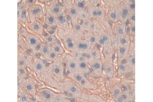 Used in DAB staining on fromalin fixed paraffin- embedded liver tissue (ABCG8 抗体  (AA 1-272))
