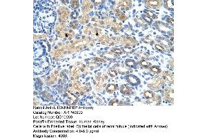 Rabbit Anti-U1SNRNPBP Antibody  Paraffin Embedded Tissue: Human Kidney Cellular Data: Epithelial cells of renal tubule Antibody Concentration: 4. (SNRNP35 抗体  (N-Term))