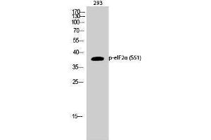 Western Blotting (WB) image for anti-Eukaryotic Translation Initiation Factor 2A, 65kDa (EIF2A) (pSer51) antibody (ABIN3172886) (EIF2A 抗体  (pSer51))
