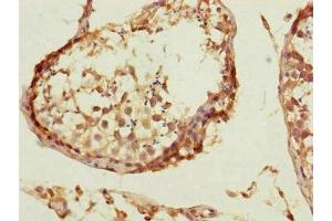 Immunohistochemistry of paraffin-embedded human testis tissue using ABIN7148059 at dilution of 1:100 (CCHCR1 抗体  (AA 483-782))