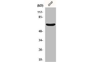 Western Blot analysis of A549 cells using MMP-11 Polyclonal Antibody