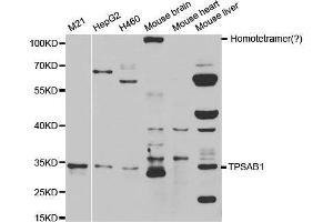 Western blot analysis of extracts of various cell lines, using TPSAB1 antibody. (TPSAB1 抗体  (AA 19-210))