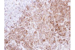 IHC-P Image Immunohistochemical analysis of paraffin-embedded SCM-1 xenograft , using HSP90B, antibody at 1:500 dilution. (GRP94 抗体  (Center))