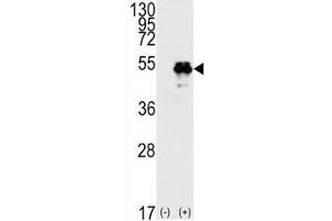 Western Blotting (WB) image for anti-Tumor Protein P53 (TP53) (AA 33-62) antibody (ABIN3029394)