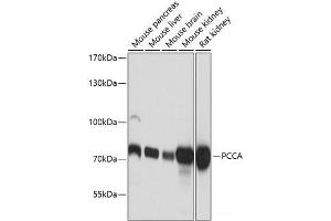 Western blot analysis of extracts of various cell lines using PCCA Polyclonal Antibody at dilution of 1:3000. (PCCA 抗体)