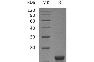 Western Blotting (WB) image for KIT Ligand (KITLG) (Active) protein (ABIN7320653) (KIT Ligand Protein (KITLG))
