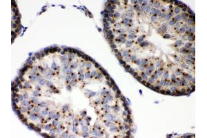 Immunohistochemistry (IHC) image for anti-Estrogen Receptor Binding Site Associated, Antigen, 9 (EBAG9) (AA 31-213) antibody (ABIN3043569)