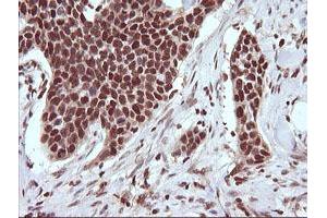 Image no. 5 for anti-Tripartite Motif Containing 38 (TRIM38) (AA 1-265) antibody (ABIN1490681)