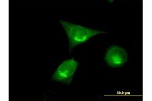 Immunofluorescence of purified MaxPab antibody to GOLGA2 on HeLa cell. (Golgin A2 (GOLGA2) (AA 1-345) 抗体)