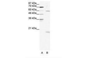 Image no. 1 for anti-SRY (Sex Determining Region Y)-Box 9 (SOX9) (AA 34-83) antibody (ABIN202687) (SOX9 抗体  (AA 34-83))